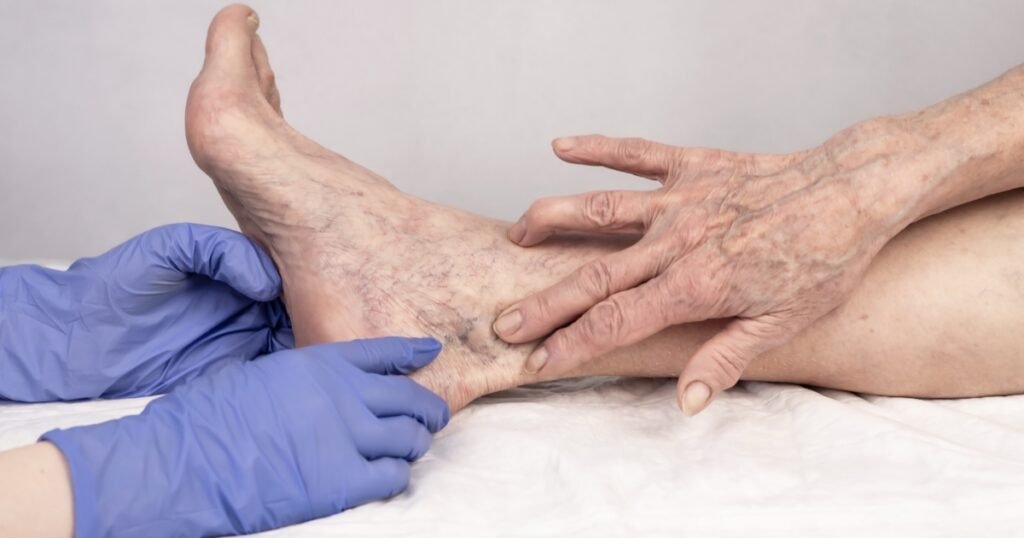 escleroterpia